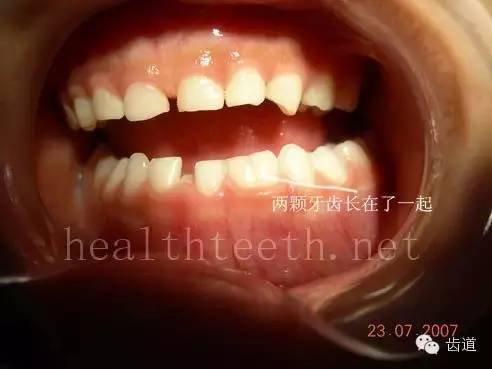 精美图片展示口腔各种病例(是牙医看了你就懂