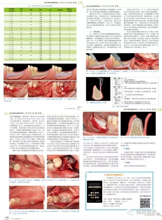 龈瓣推进术中双瓣切口和骨膜松弛切口的比较