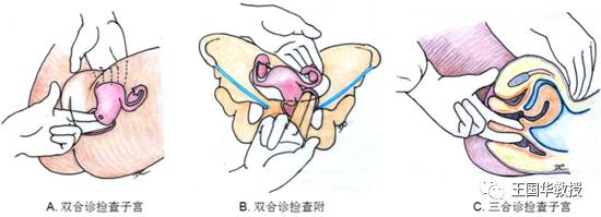 妇科门诊检查知多少?