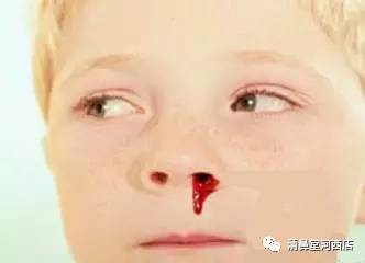 患鼻炎的孩子为何容易流鼻血