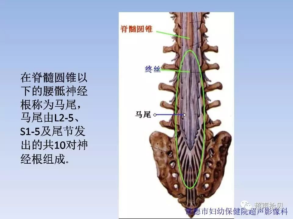 胎儿脊柱异常的超声检查系列(4)脊髓纵裂(上篇