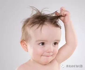 【东北育才幼儿园】警惕儿童病理性脱发!_水滴