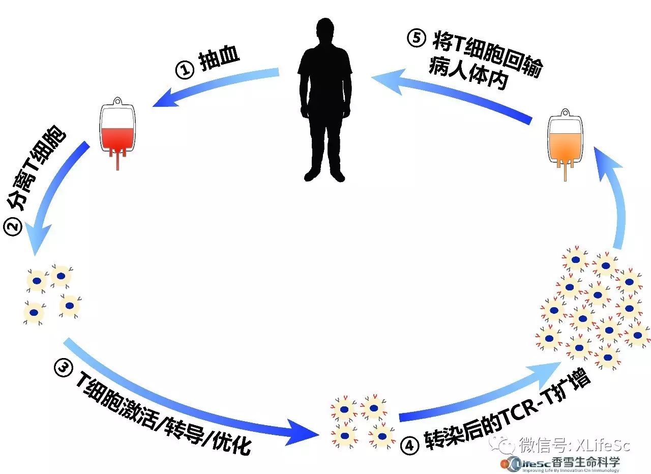 新型抗肿瘤免疫治疗:TCR-T细胞临床试验