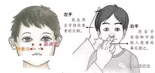 孩子各种鼻炎鼻塞,图解六步推拿法,效果很灵验