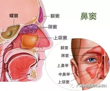 【广州协佳医院耳鼻喉科】鼻窦的位置,你知道