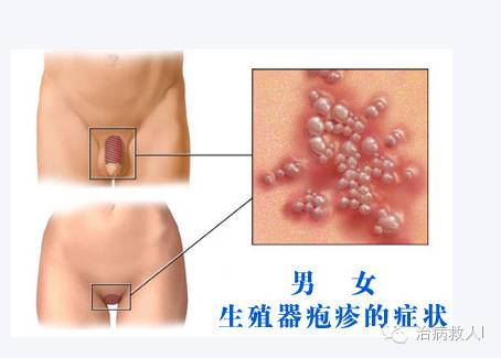 梅毒医院哪家比较好 昆明治疗淋病到医院挂什么科