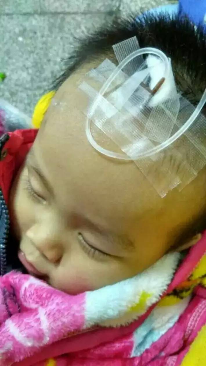 【翁源】救救翁源龙仙不幸得了脑瘫的两岁小朋