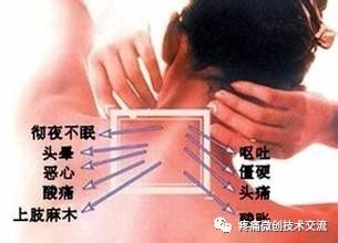 名师精讲:颈椎病精准疗法培训班11月8日北京举