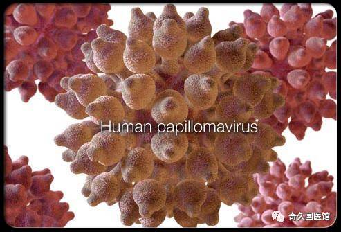 HPV病毒与癌症的关系
