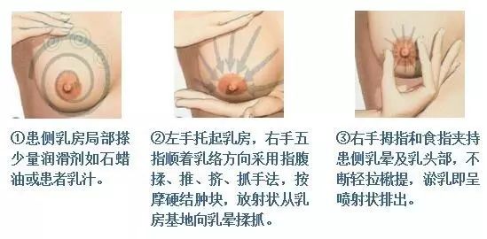 邱县中医院--哺乳期妇女乳腺炎的预防和治疗