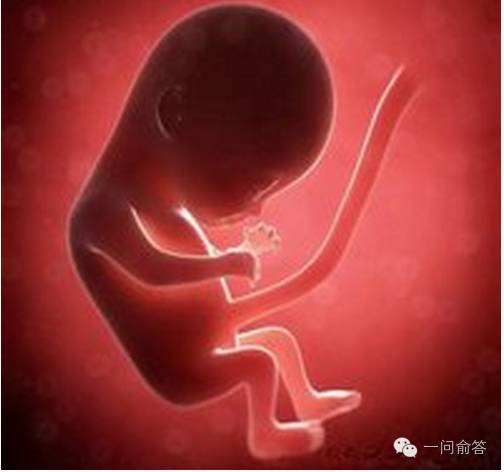 胎儿疾病诊断的标准