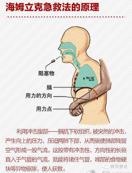 生活│1岁宝宝咳嗽近两月 原来肺部藏了三根鱼