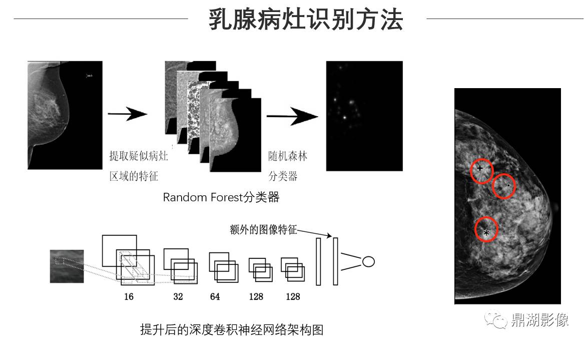 观点 | 医学影像跨界融合才是发展未来