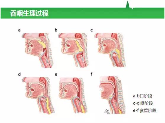 【ISPRMDC-精彩预告】吞咽障碍专场:从诊断