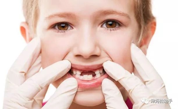 【微育儿】儿童牙齿烂掉只剩牙根怎么处理?