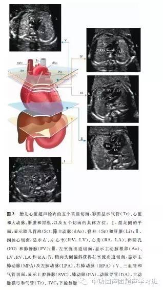 ISUOG 胎儿心脏超声检查指南(修订版)