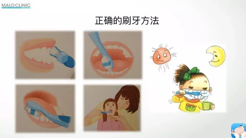 分享 | 0-3岁儿童口腔保健 父母必学知识