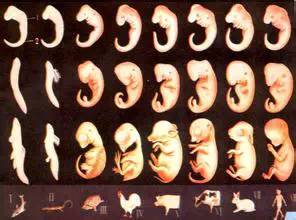 胎儿致死性成骨发育不全一例