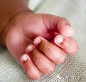 宝宝的指甲暗示了哪些健康隐患?如何养护宝宝